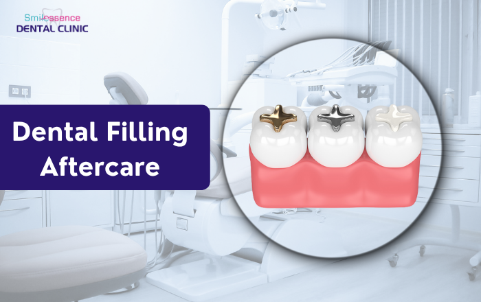 Dental Filling Aftercare: Foods You Should Avoid and Why