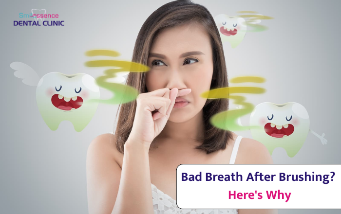 Why Does My Breath Smell Bad Even After Brushing?