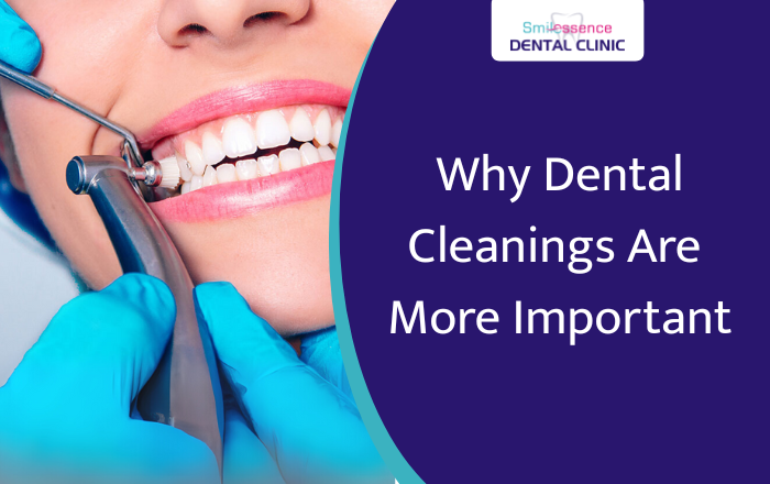 Why Dental Cleanings Are More Important Than You Think