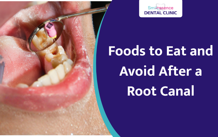 What to Eat (and Skip) After a Root Canal for a Smooth Recovery