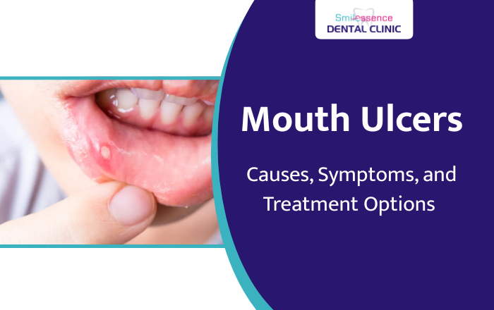 Mouth Ulcers: Causes, Symptoms, and Best Treatment Options