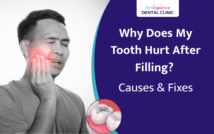 Why Does My Tooth Hurt After Filling? Causes & Fixes